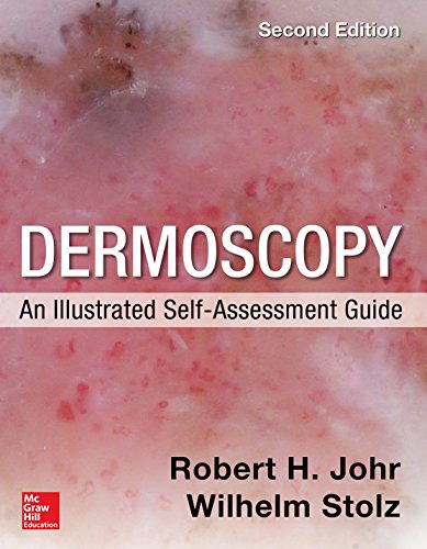 Book Cover Dermoscopy: An Illustrated Self-Assessment Guide, 2/e