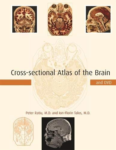 Book Cover Cross-sectional Atlas of the Brain and DVD