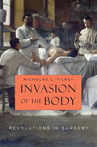 Book Cover Invasion of the Body: Revolutions in Surgery