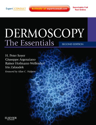 Book Cover Dermoscopy: The Essentials: Expert Consult - Online and Print