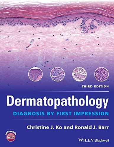 Book Cover Dermatopathology: Diagnosis by First Impression