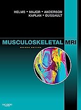 Book Cover Musculoskeletal MRI, 2e