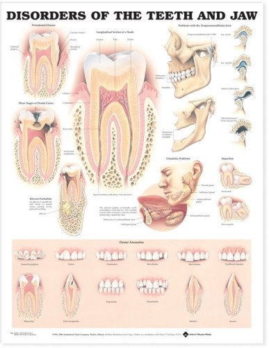Book Cover Disorders of the Teeth and Jaw Anatomical Chart
