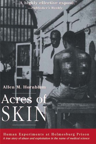 Book Cover Acres of Skin: Human Experiments at Holmesburg Prison