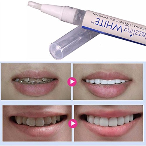 Book Cover Teeth Whitening Gel Pen, Coohole White Tooth Cleaning Bleaching Dental Cleaner Professional Kit (Blue)