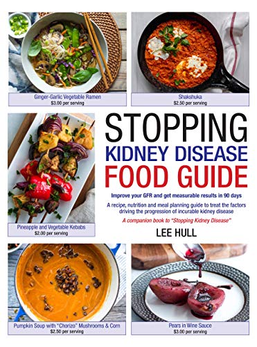 Book Cover Stopping Kidney Disease Food Guide: A recipe, nutrition and meal planning guide to treat the factors driving the progression of incurable kidney disease