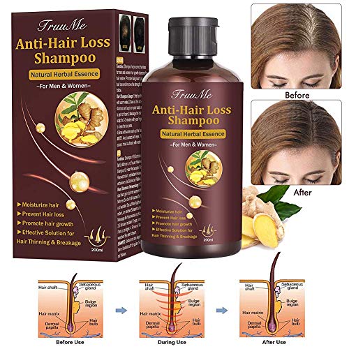 Book Cover Hair Growth Shampoo, Hair Loss Shampoo, Hair Thickening Shampoo, Helps Stop Hair Loss, Grow Hair Fast, Hair Loss Treatment for Men & Women (220mL)